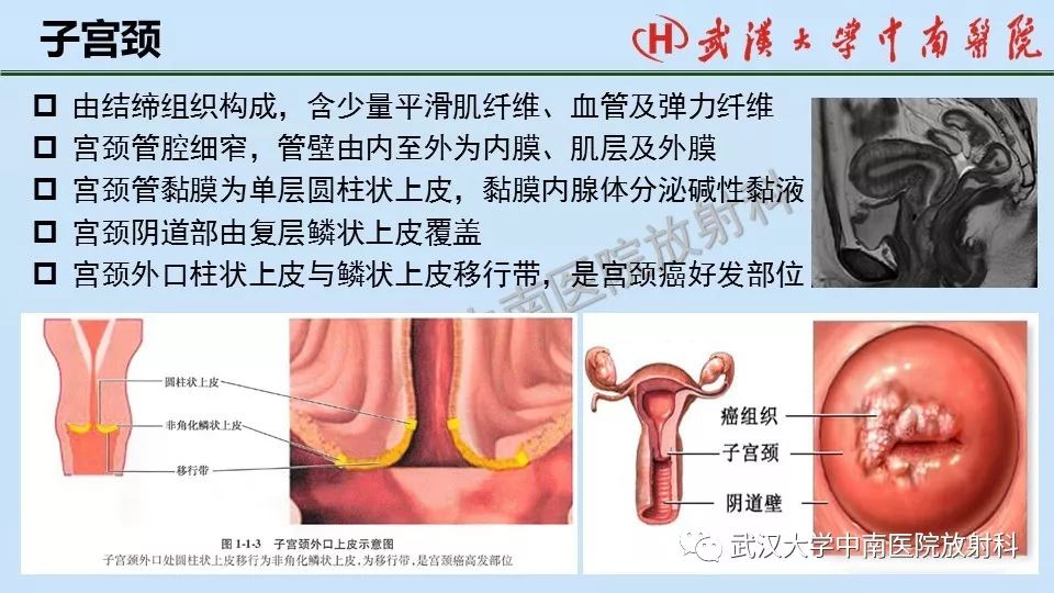 【PPT】女性生殖系统影像解剖及子宫常见疾病
