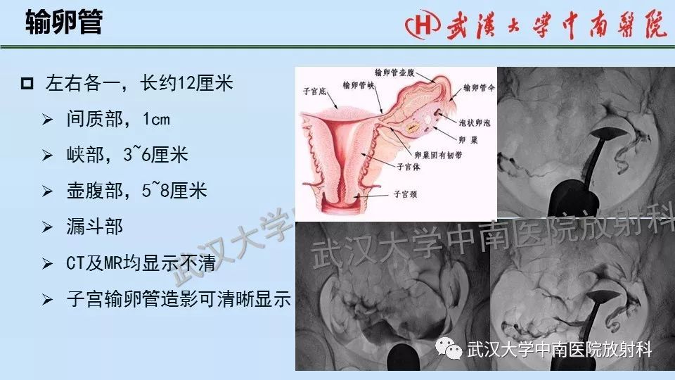 【PPT】女性生殖系统影像解剖及子宫常见疾病