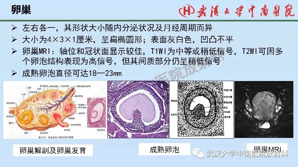 【PPT】女性生殖系统影像解剖及子宫常见疾病