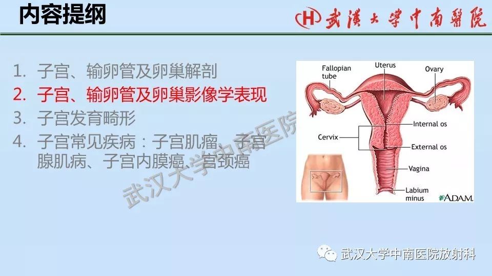 【PPT】女性生殖系统影像解剖及子宫常见疾病