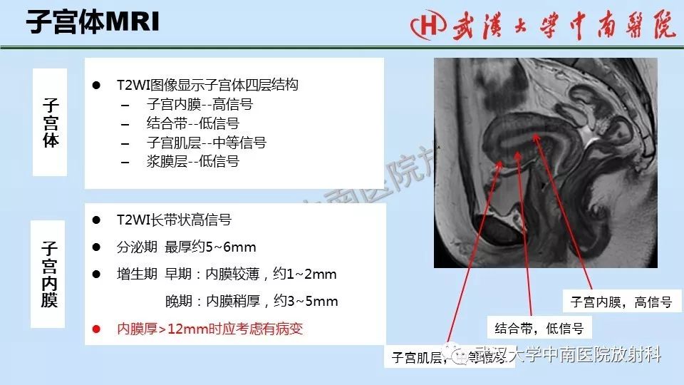 【PPT】女性生殖系统影像解剖及子宫常见疾病
