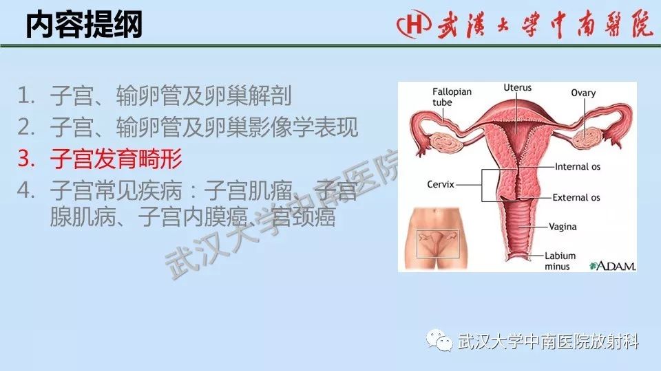 【PPT】女性生殖系统影像解剖及子宫常见疾病