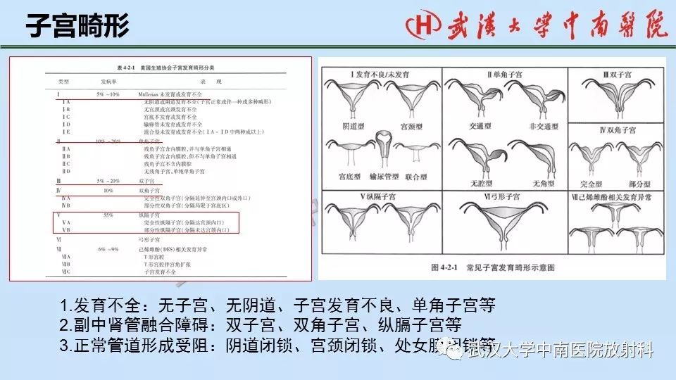 【PPT】女性生殖系统影像解剖及子宫常见疾病