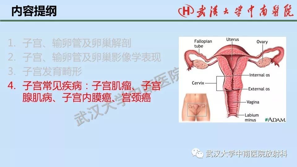 【PPT】女性生殖系统影像解剖及子宫常见疾病