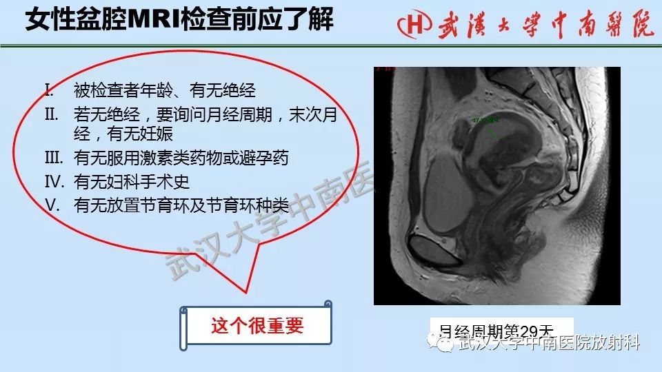 【PPT】女性生殖系统影像解剖及子宫常见疾病