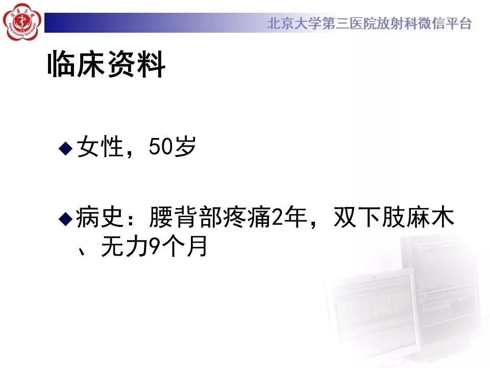 【病例】脊柱孤立性浆细胞瘤1例CT及MR影像