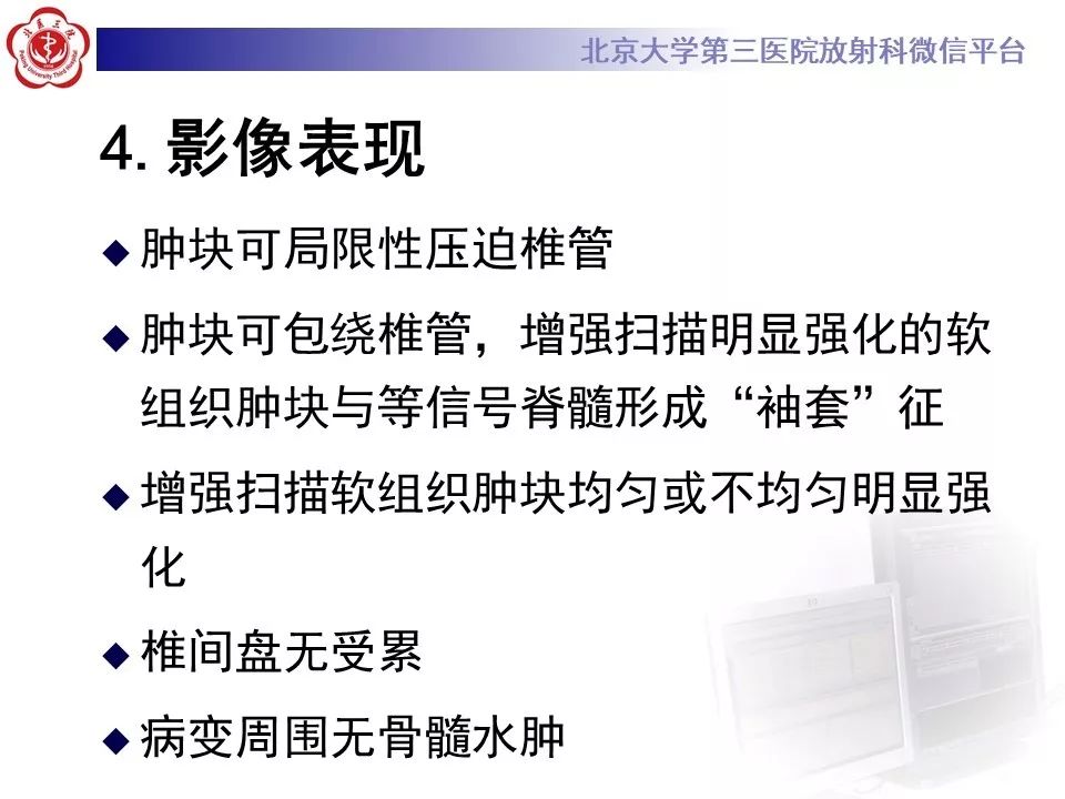 【病例】脊柱孤立性浆细胞瘤1例CT及MR影像