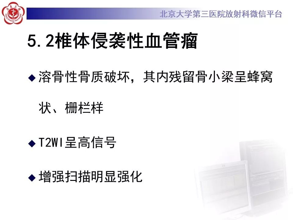 【病例】脊柱孤立性浆细胞瘤1例CT及MR影像