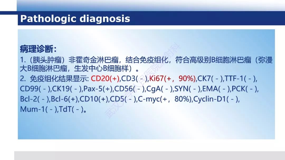 【PPT】胰腺淋巴瘤影像诊断