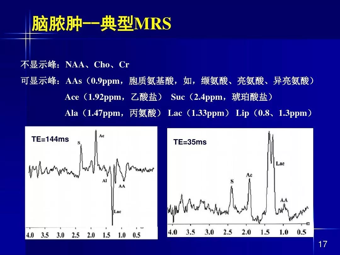 【PPT】脑内常见环形强化病变影像诊断与鉴别诊断