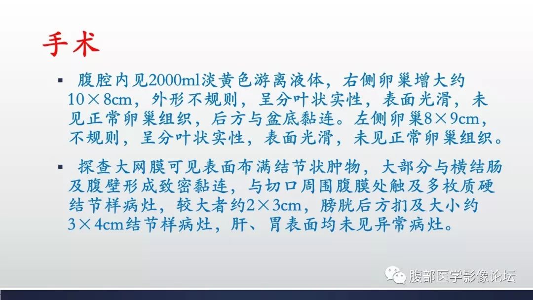 【病例】卵巢黄素化卵泡膜细胞瘤1例CT影像