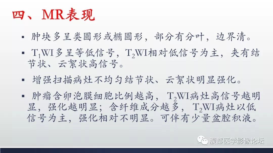 【病例】卵巢黄素化卵泡膜细胞瘤1例CT影像