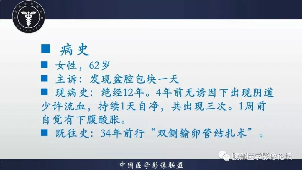 【病例】小肠间质瘤1例CT影像