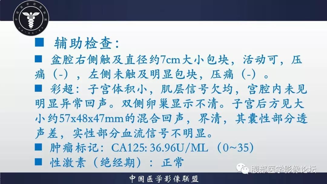 【病例】小肠间质瘤1例CT影像