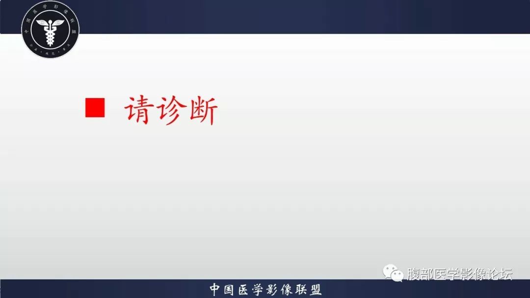 【病例】小肠间质瘤1例CT影像