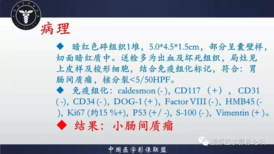 【病例】小肠间质瘤1例CT影像