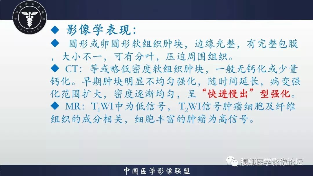 【病例】小肠间质瘤1例CT影像