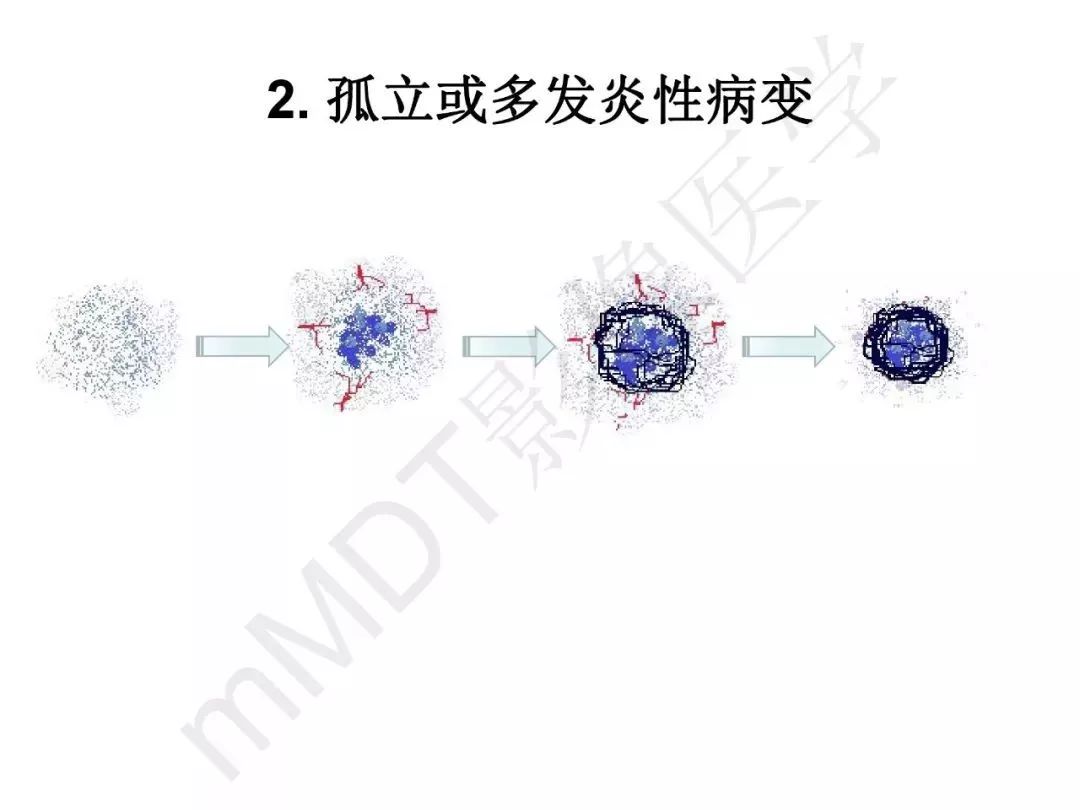 【PPT】纤维组织在肝脏炎性病变MR诊断中的价值