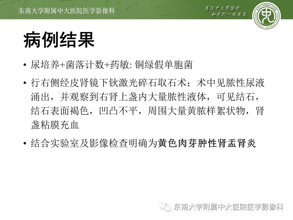 【病例】黄色肉芽肿性肾盂肾炎1例CT影像