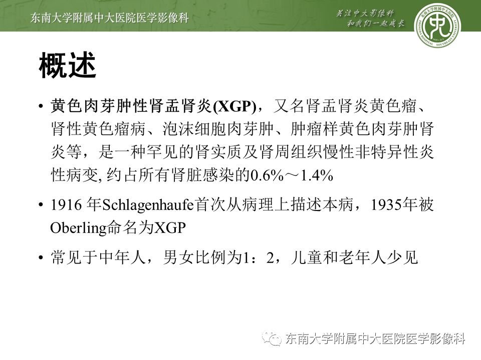 【病例】黄色肉芽肿性肾盂肾炎1例CT影像