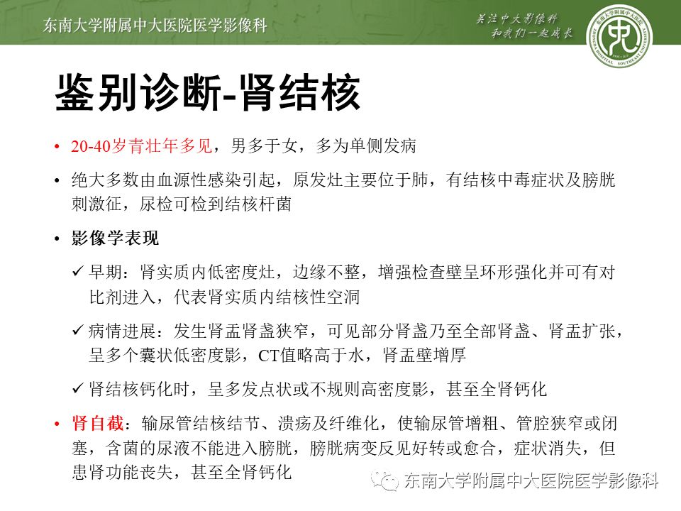 【病例】黄色肉芽肿性肾盂肾炎1例CT影像