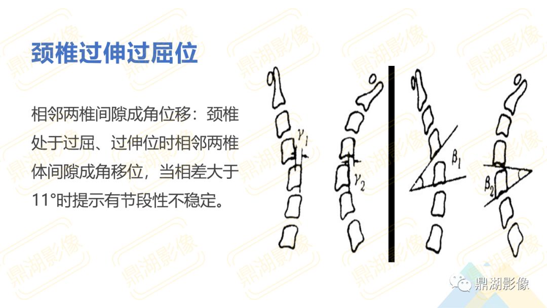 【PPT】脊柱X线测量