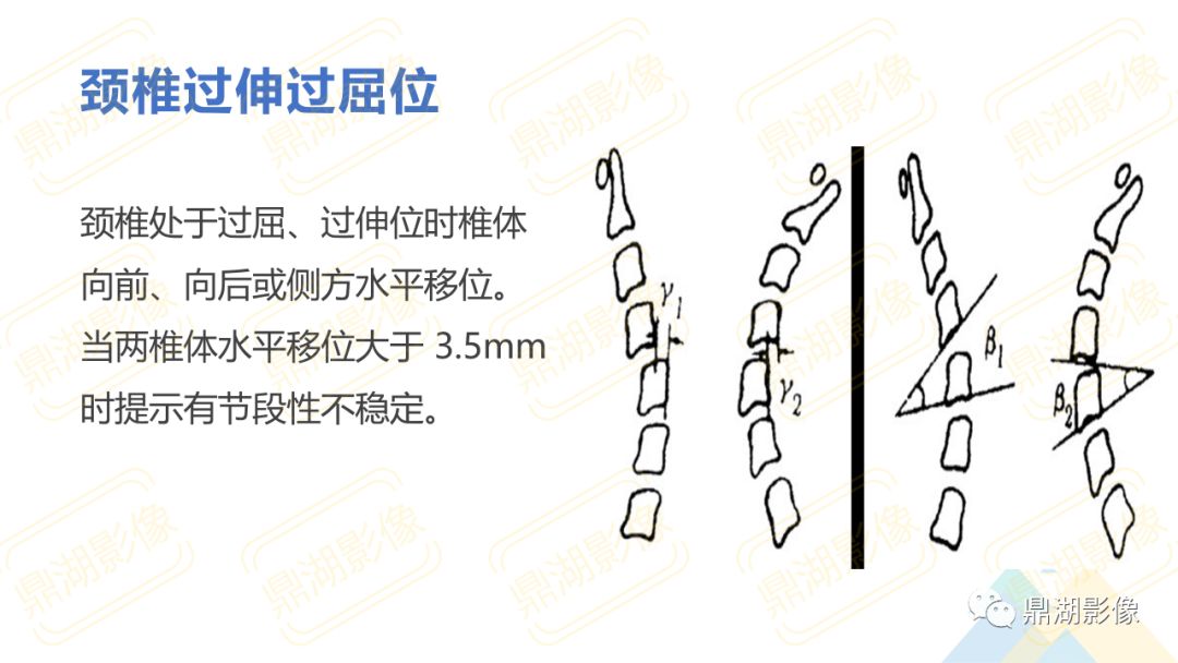 【PPT】脊柱X线测量