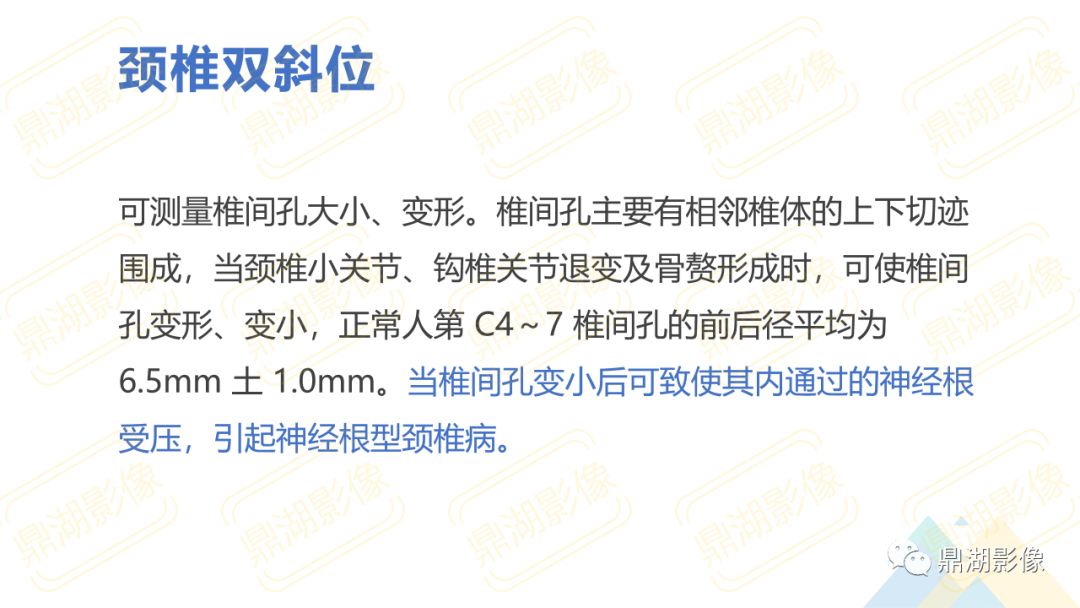 【PPT】脊柱X线测量