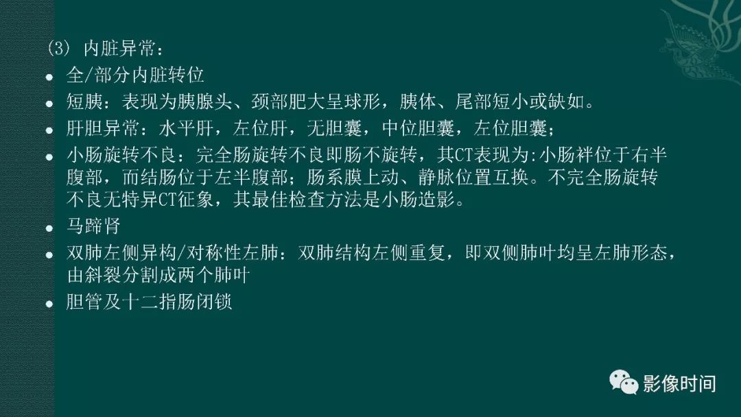 【PPT】多脾综合征