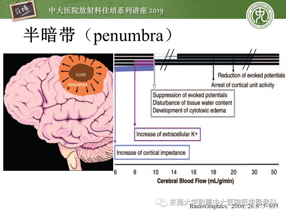 【PPT】急性缺血性脑卒中的影像评估