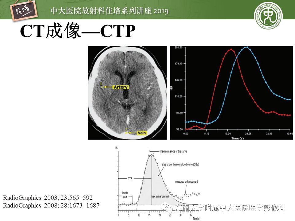 【PPT】急性缺血性脑卒中的影像评估