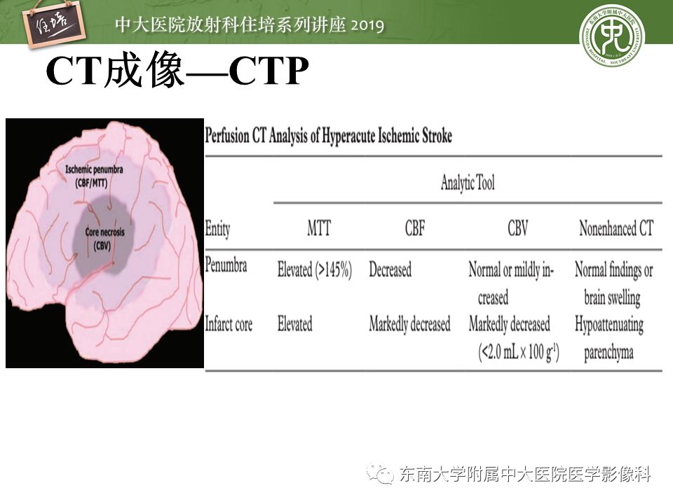 【PPT】急性缺血性脑卒中的影像评估