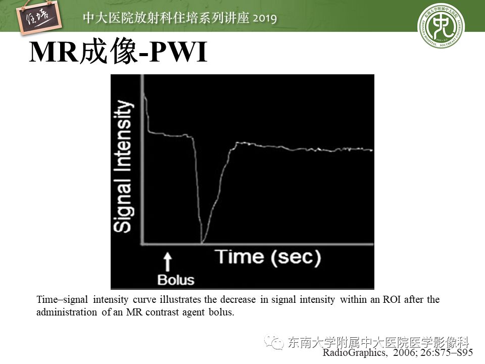 【PPT】急性缺血性脑卒中的影像评估