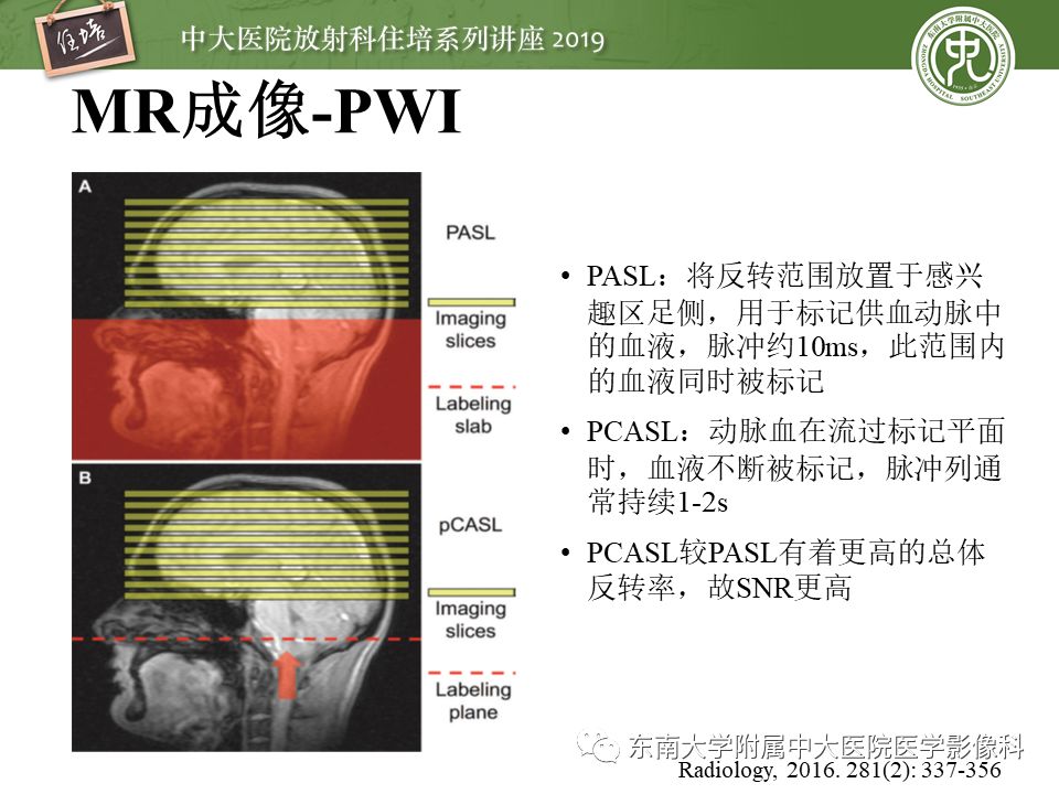 【PPT】急性缺血性脑卒中的影像评估