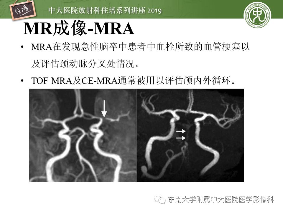 【PPT】急性缺血性脑卒中的影像评估