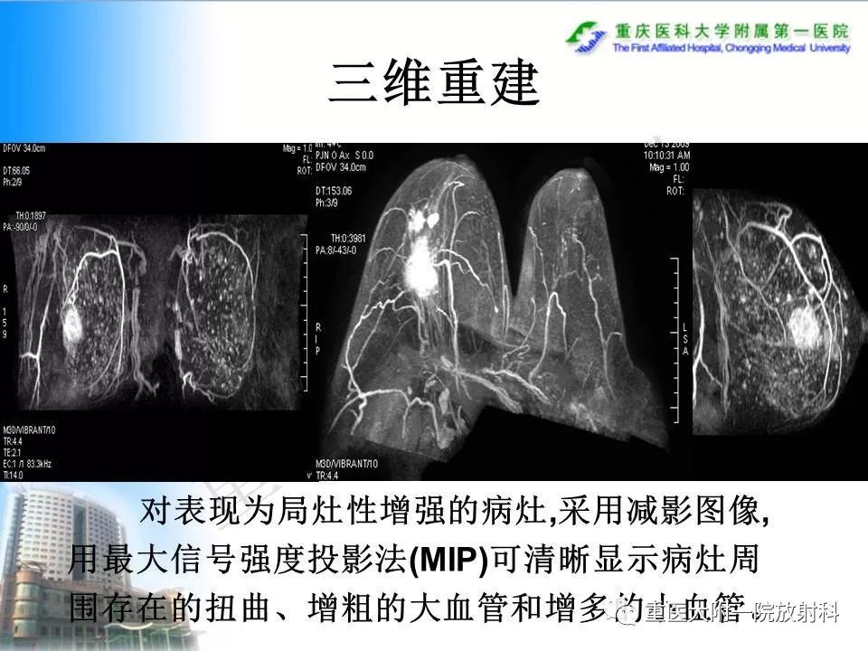 自动草稿