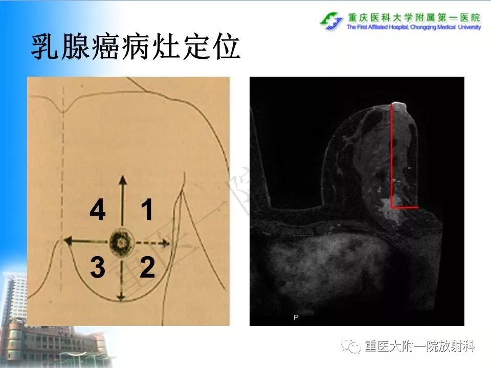 自动草稿