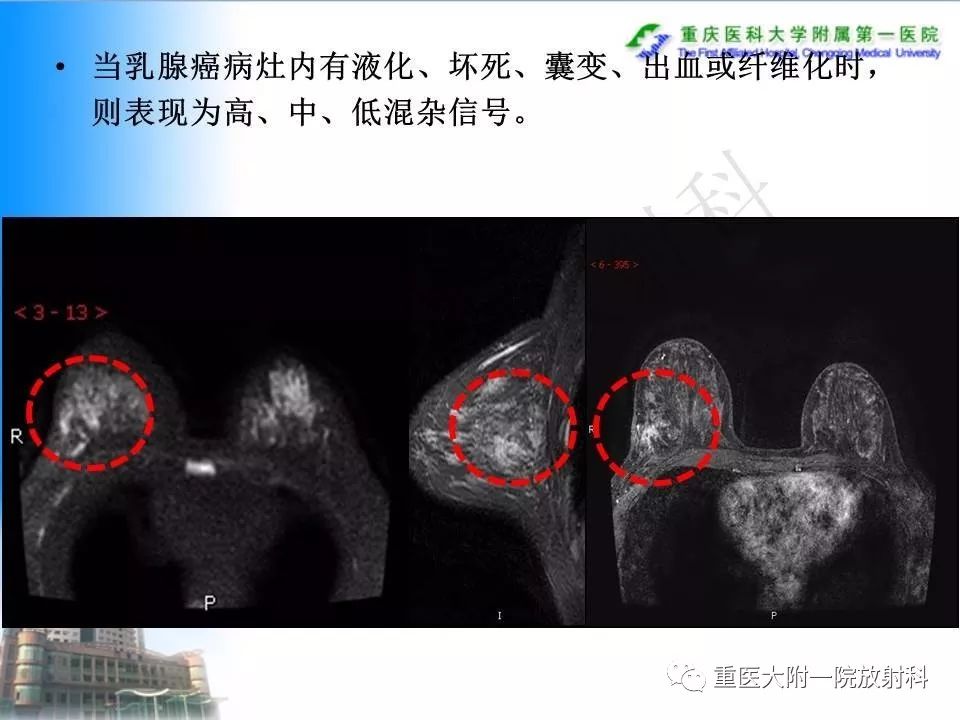 自动草稿