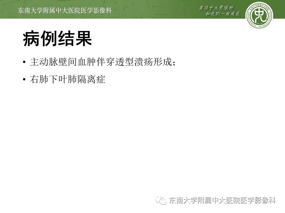 【病例】肺隔离症1例CT影像
