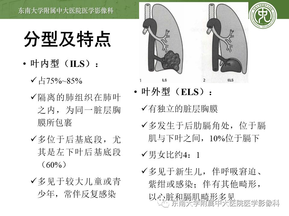 【病例】肺隔离症1例CT影像
