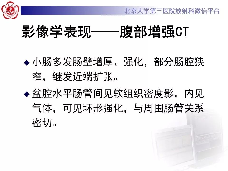 【病例】克罗恩病1例CT影像