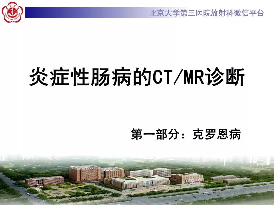 【病例】克罗恩病1例CT影像