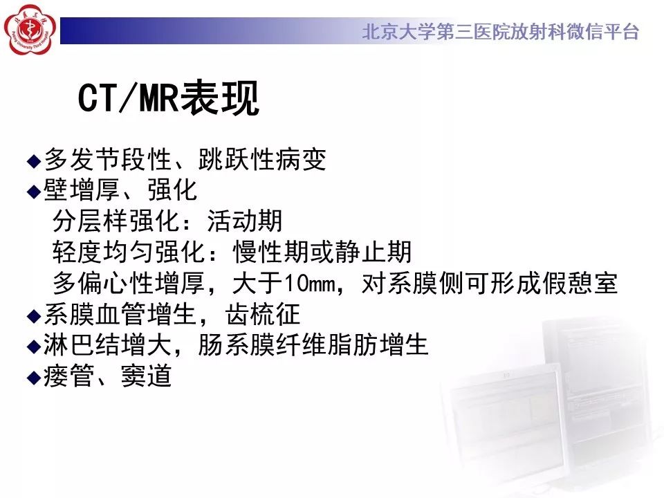 【病例】克罗恩病1例CT影像