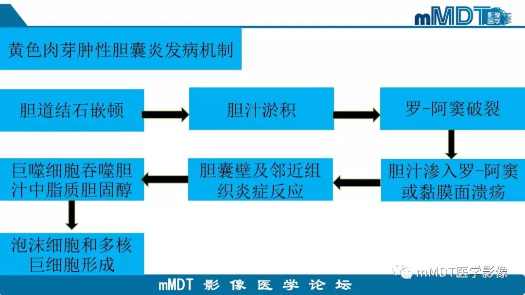 【PPT】黄色肉芽肿性胆囊炎与厚壁型胆囊癌的影像表现及鉴别要点