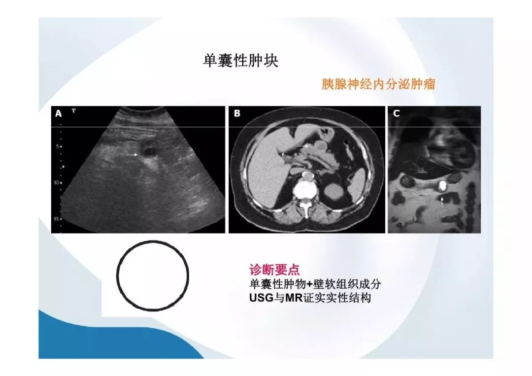 【PPT】胰腺非常见肿瘤影像学检查与诊断思路