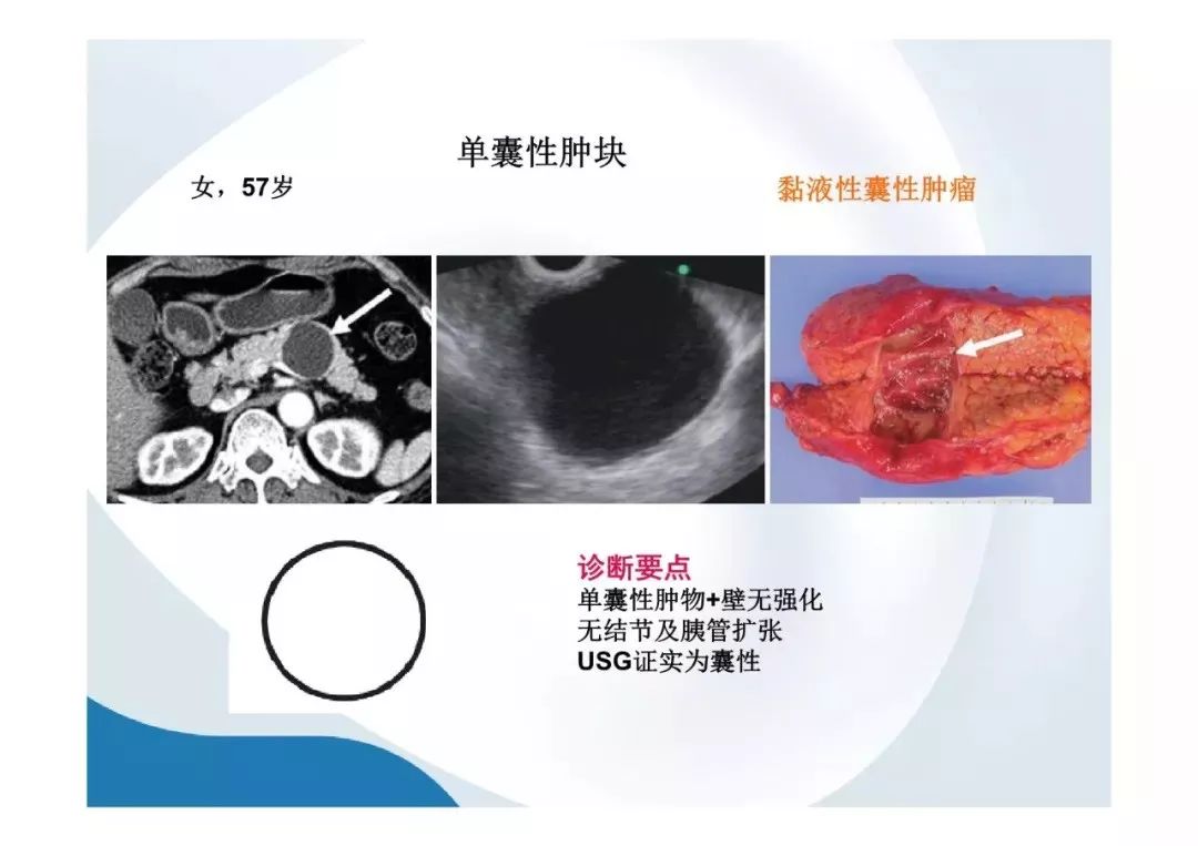 【PPT】胰腺非常见肿瘤影像学检查与诊断思路