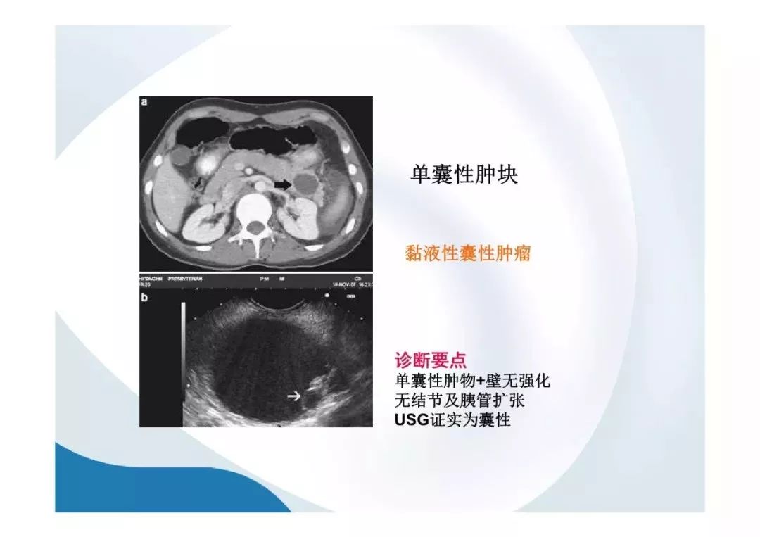 【PPT】胰腺非常见肿瘤影像学检查与诊断思路