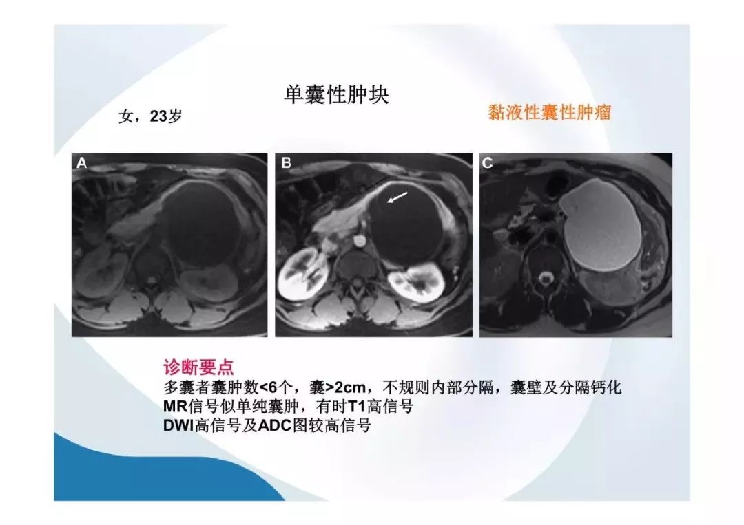 【PPT】胰腺非常见肿瘤影像学检查与诊断思路