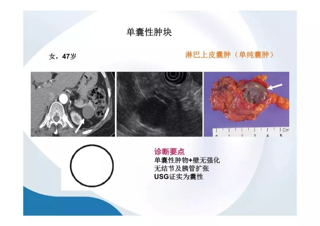 【PPT】胰腺非常见肿瘤影像学检查与诊断思路