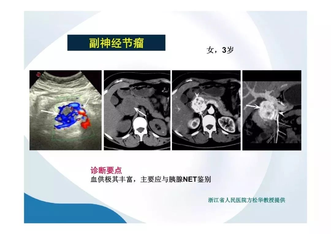 【PPT】胰腺非常见肿瘤影像学检查与诊断思路